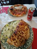 Liposuccion